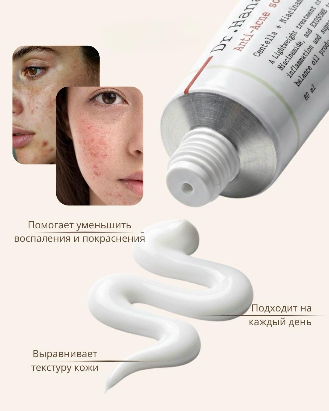 Dr. Martens Крем для лица Dr. Hana Anti-Acne Solution — фото 2