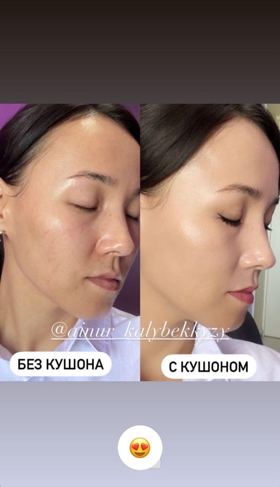 Атоми Кушон Атоми+1 запаска — фото 2