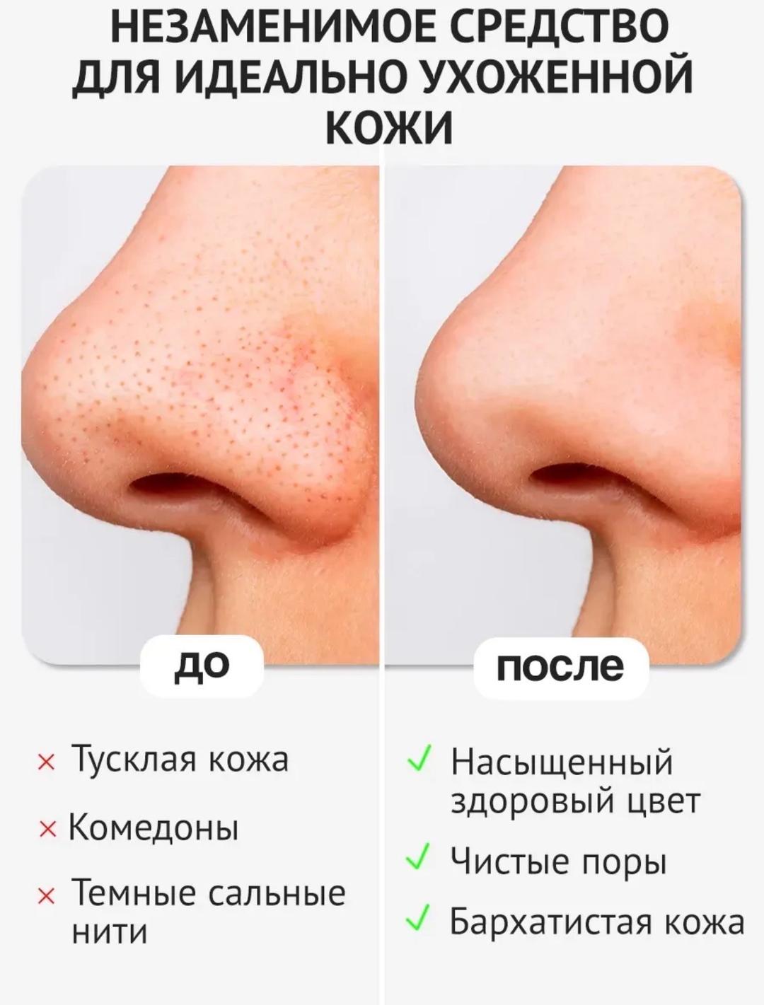 eshumi Корейская очищающая пилинг-скатка для лица — фото 2