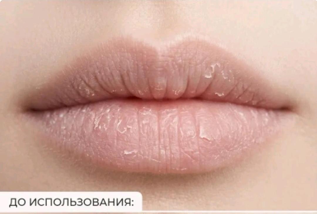 arocell Arocell Botulcare Lip Serum Mask — интенсивная сыворотка-маска для губ — фото 2
