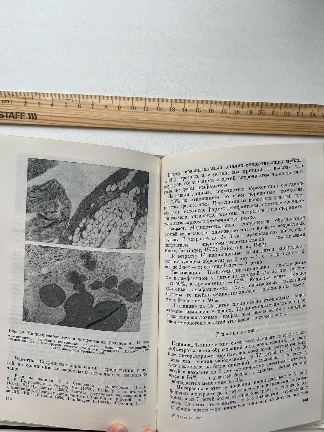 Ю.Ф. Исаков, Э.А. Степанов Опухоли и кисты грудной полости у детей — фото 2