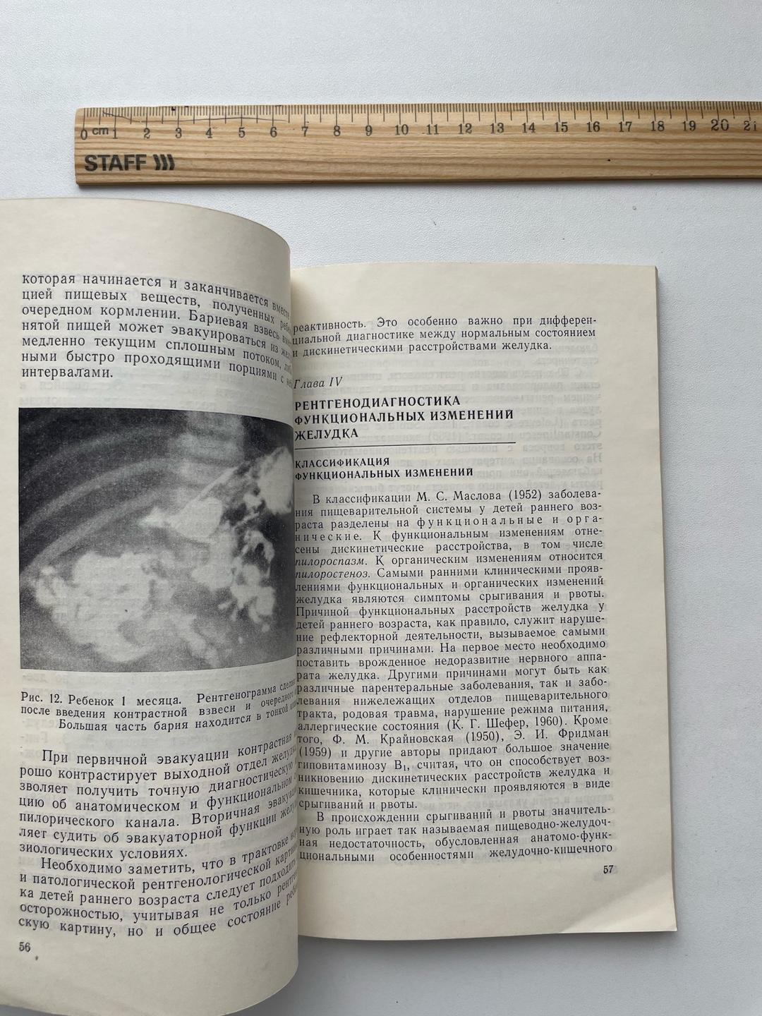 Ю.Р. Левин Рентгеногастрография у детей раннего возраста — фото 2