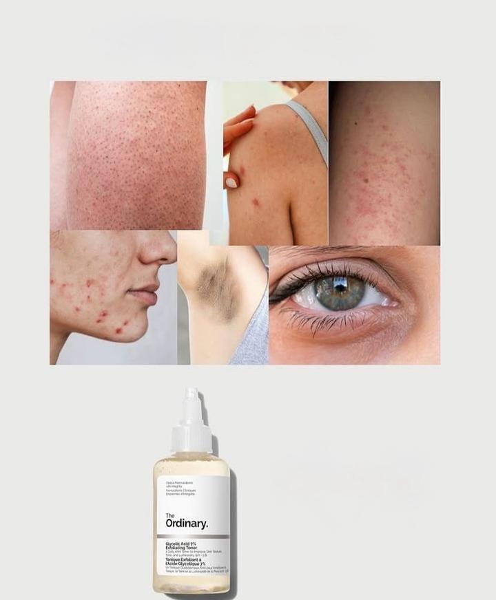 The Ordinary