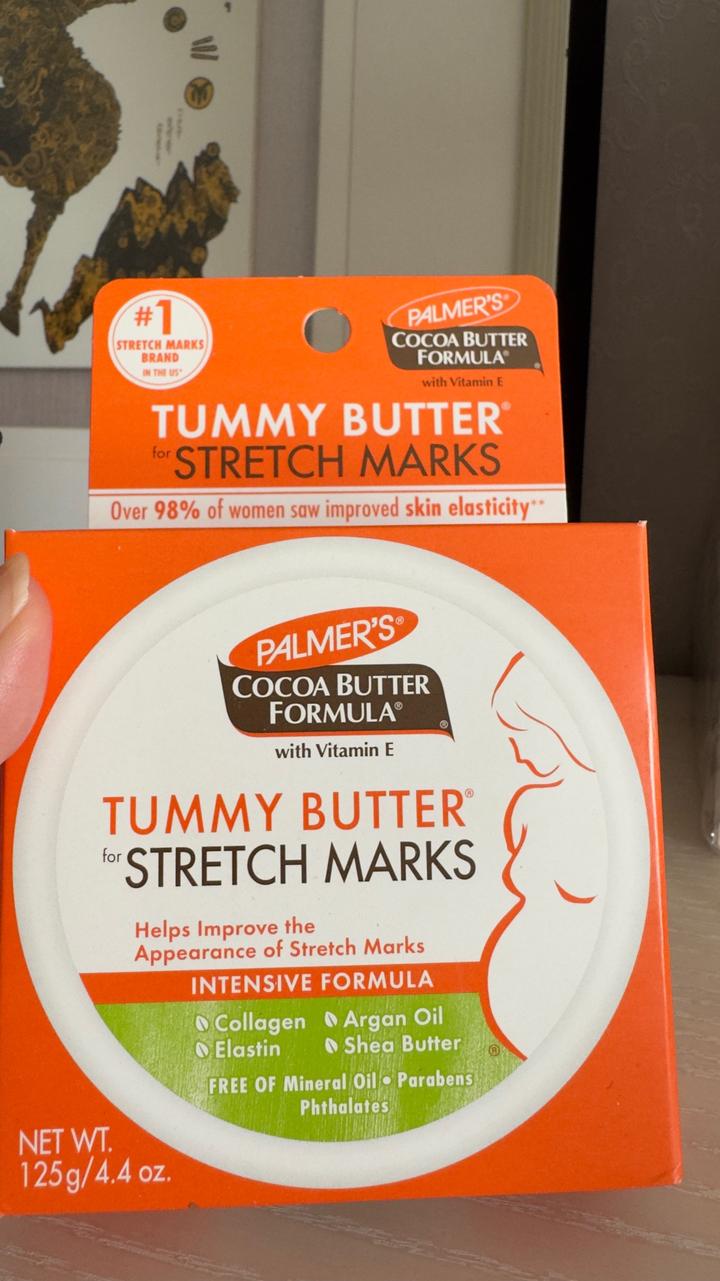 Palmer's