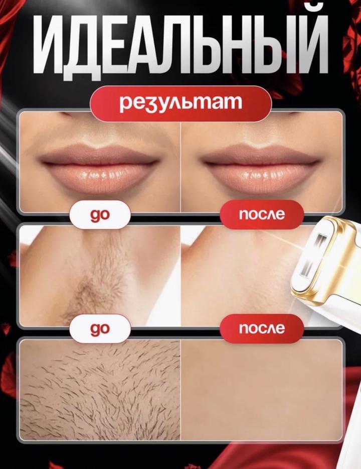Arbeee фотоэпилятор Remelle Touch