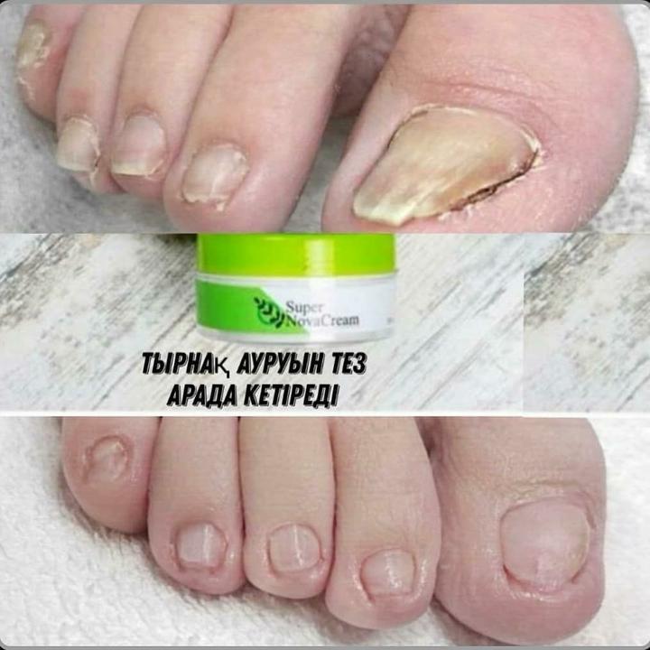 Супер нова крем