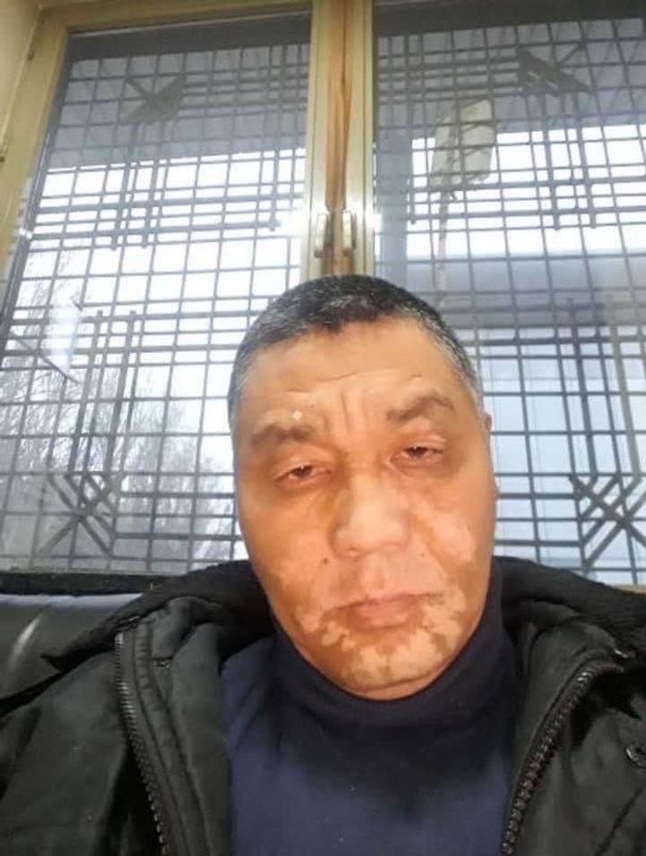 Хемохим Атоми