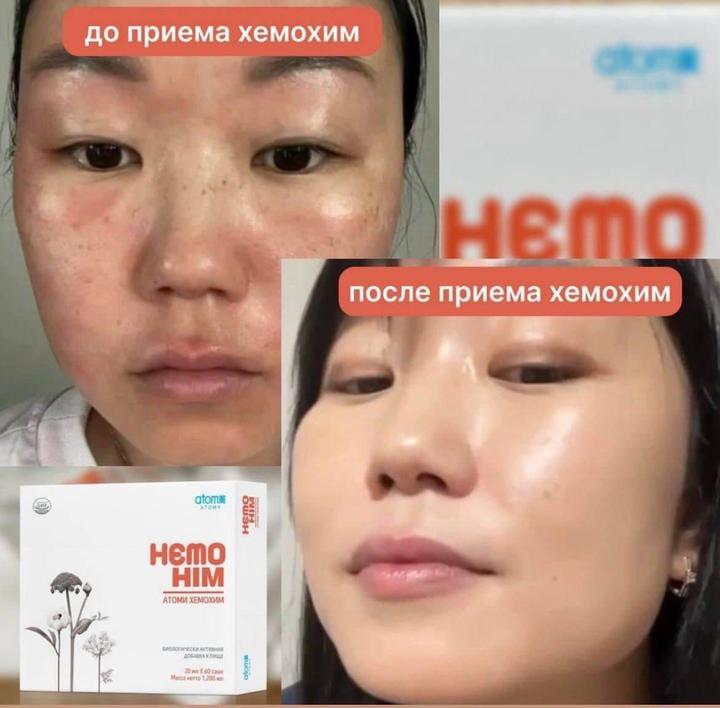 Хемохим Атоми